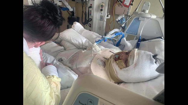 USA, imita una challenge su TikTok e resta ustionata: gravissima una bambina