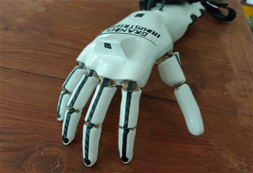 Torino, perde la mano e la vista: l’amico costruisce per lui una mano robotica
