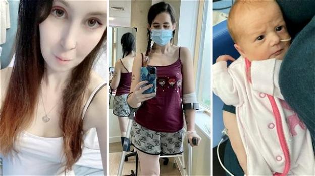 UK, 28enne scopre di avere il cancro in gravidanza e si amputa la gamba per poter partorire