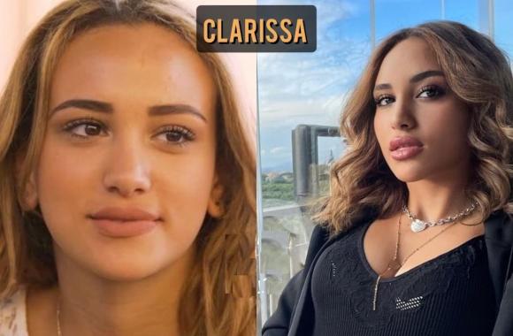 Le Principesse Selassie Sono Ricorse Alla Chirurgia Estetica Le Foto Del Prima E Dopo
