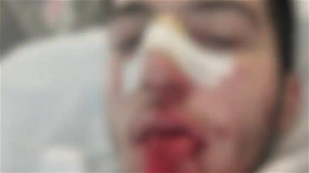 Cosenza, Emanuele pestato a sangue davanti scuola: il presunto aggressore confessa