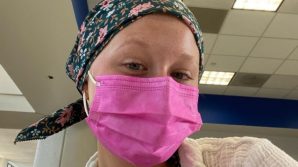 Miranda McKeon mostra i segni di cancro e chemio: