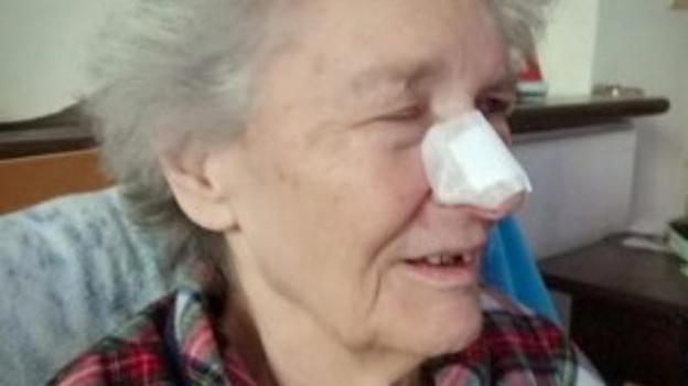 Falconara, notte di terrore per un’anziana: morsa da un ratto nel sonno, è finita in ospedale