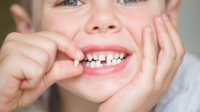I denti da latte possono predire il rischio di sviluppare disturbi mentali