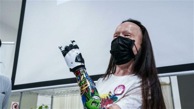 Il sogno di Valentina Pitzalis diventa realtà: dopo 10 anni dal suo tentato omicidio, riceve una mano bionica