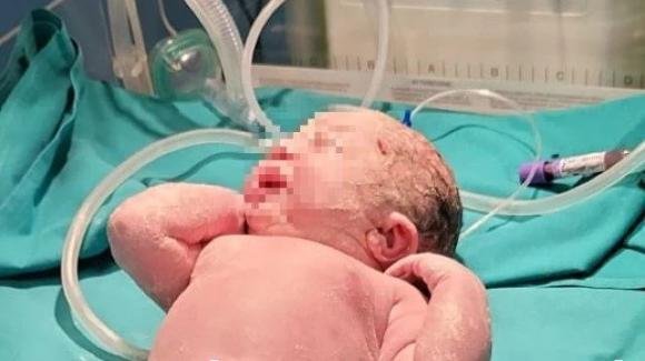 Roma: si chiama Olivia la prima bimba nata nella Capitale e in Italia nel 2022