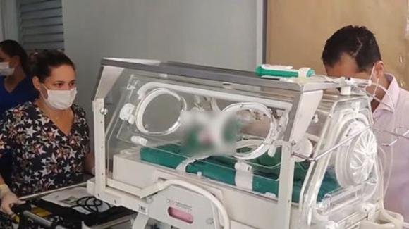 Brasile: neonato prematuro dichiarato morto dai medici, il becchino scopre che è ancora vivo