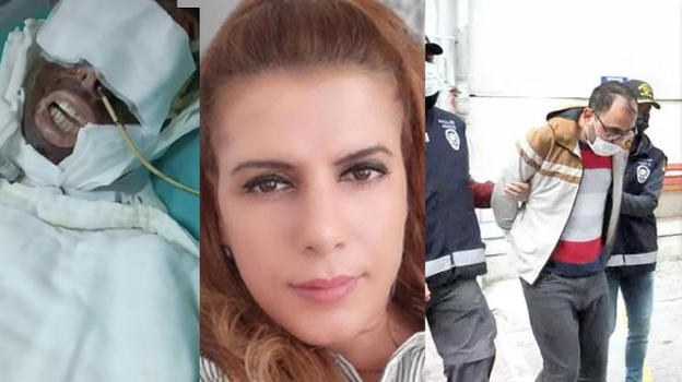 Turchia: versò acido in faccia all’amica nel sonno perché rifiutò le sue avances, al via il processo