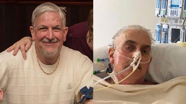 Ricevette in trapianto il cuore di un maiale: David Bennet muore due mesi dopo l’operazione rivoluzionaria
