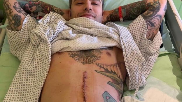 Fedez dopo l’operazione: “Ho scoperto di avere un raro tumore al pancreas”