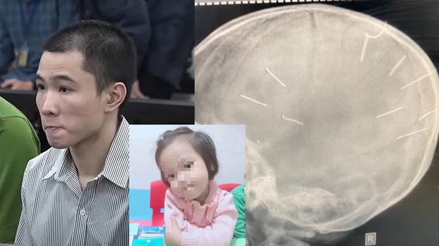 Vietnam: uccise la figlia della compagna martellandole 10 chiodi nel cranio, condannato a morte