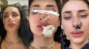 Greta Menchi aggredita da un cane: