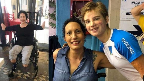 "Tutti gli arti amputati per un tumore che non c’era", madre di Terni fa causa a 3 ospedali