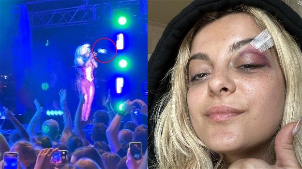 Bebe Rexha hit in the face by phone thrown by a fan, star needs points
