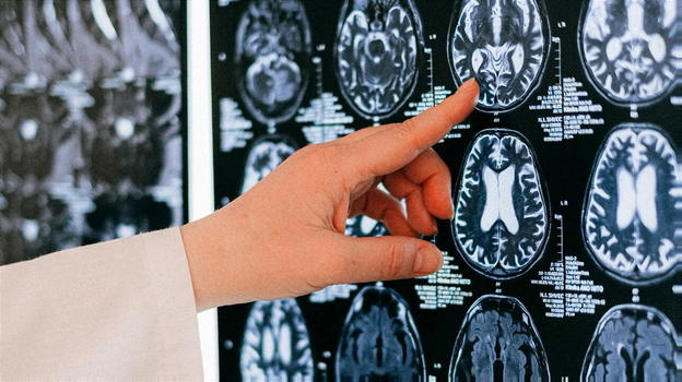 Il cambiamento climatico sta riducendo le dimensioni del nostro cervello