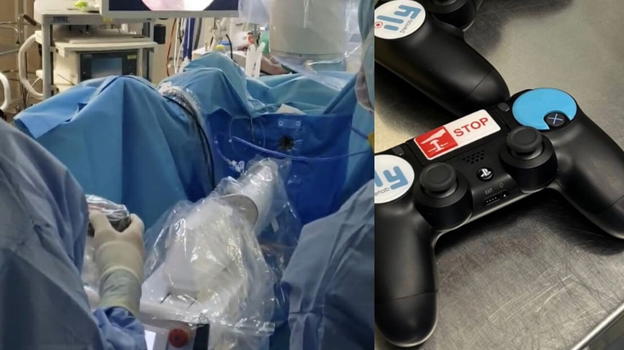 Calcoli renali rimossi con una Playstation