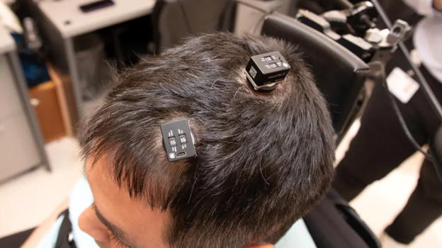 Medicina bioelettronica: tetraplegico torna a muovere le mani grazie a 5 microchip impiantati nel cervello