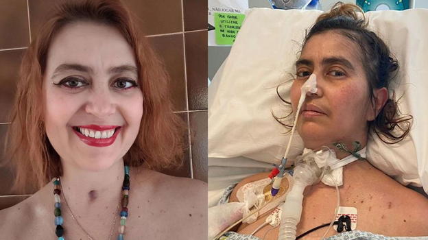 Brasile: prende il botulismo mangiando pesto scaduto, un anno di calvario
