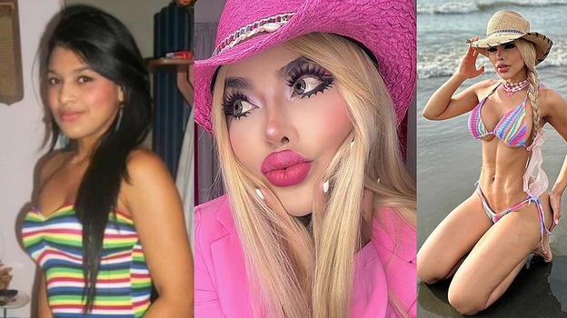 29 interventi per diventare una Barbie umana: "A scuola mi prendevano in giro per la pelle scura"