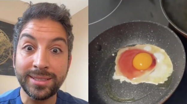Mangia un uovo rosso per fare un video su TikTok: ricoverato in ospedale per una grave infezione