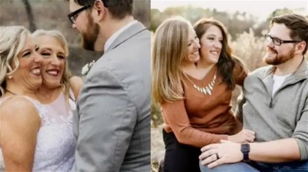 Gemelle siamesi bicefali si uniscono in matrimonio: il filmato fa il giro del web