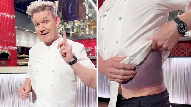 Gordon Ramsay rivela le conseguenze del suo incidente