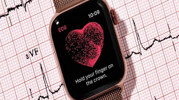 Apple vince la causa contro AliveCor: l’Apple Watch resta sul mercato senza restrizioni
