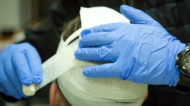 Riceve pallonata in faccia, finisce a terra per poi andare in ospedale