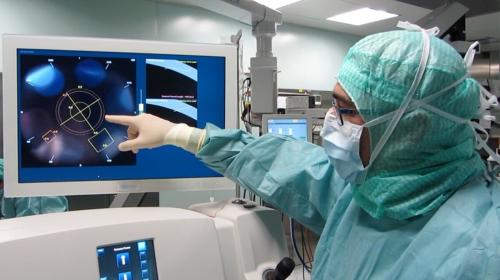 Pescara, l’ipermetropia elevata si corregge senza bisturi e con tempi di recupero rapidi