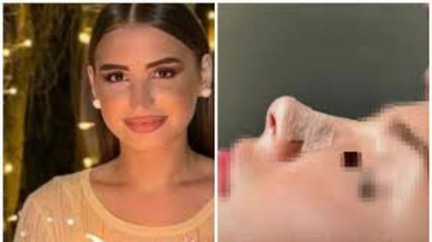 Margaret Spada, 22 anni persi in 36 minuti: la rinoplastica finita in imprevisto fatale