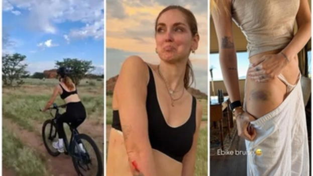 Chiara Ferragni scivola in bici nella savana namibiana e si fa un grosso livido