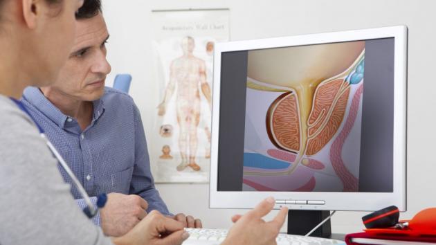 Prostata ingrossata: sintomi e rimedi dell’ipertrofia prostatica benigna