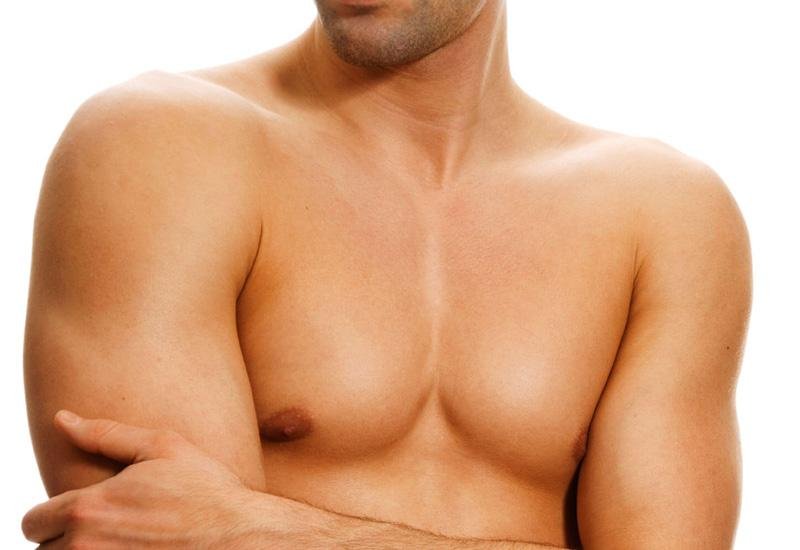Ginecomastia: come eliminare il seno maschile