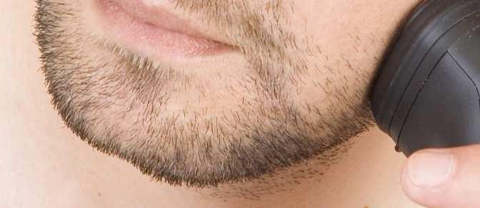 Trapianto di barba: cos'è, dove farlo e quanto costa
