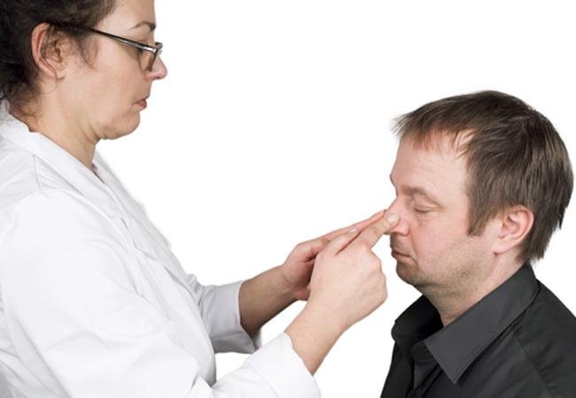Setto nasale deviato: rischi e costi della settoplastica
