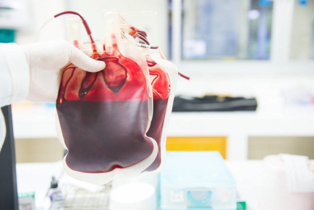 Per le forme di moderata o seria entità, sono necessarie frequenti trasfusioni di sangue