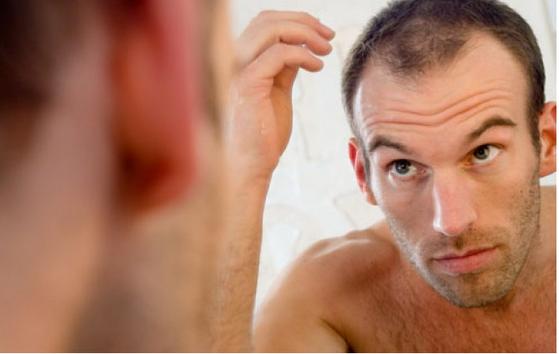 Stop alla calvizie: la cura naturale può venire dalle foglie di guava