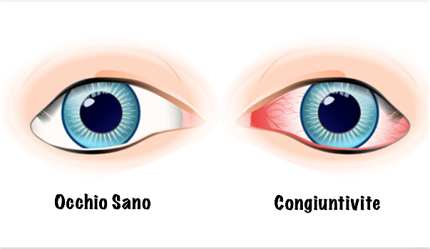Ecco 8 cose che danneggiano seriamente i tuoi occhi: fai attenzione!