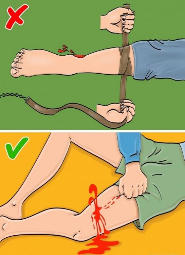 Queste tecniche di primo soccorso possono fare più male che bene