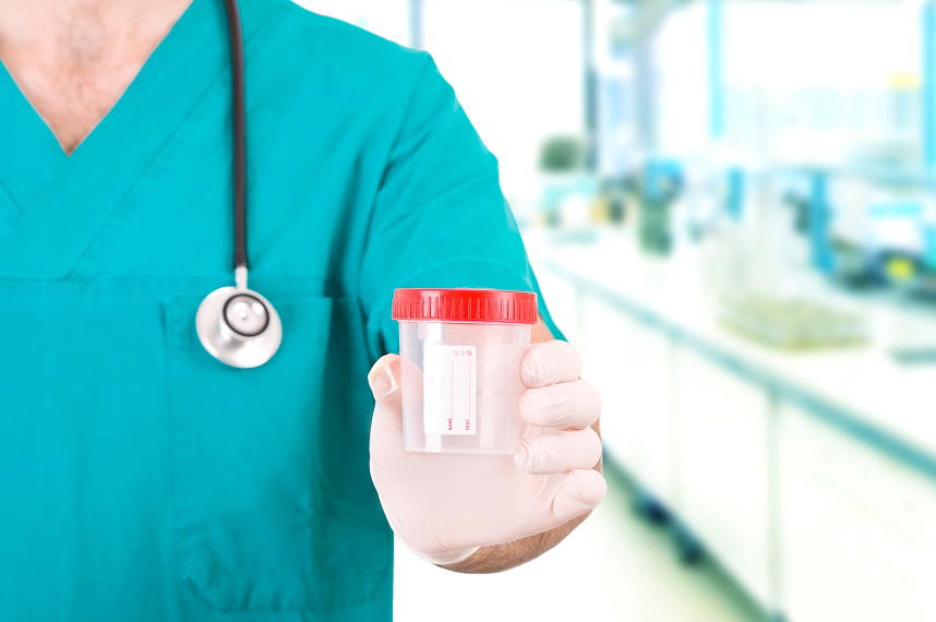 Eritrociti nelle urine: cause, i valori normali e quando preoccuparsi