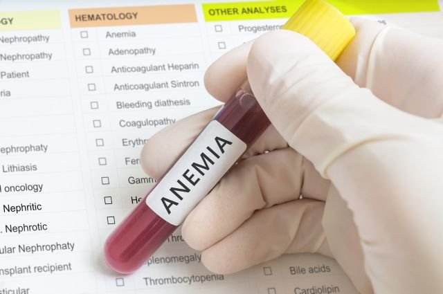 L'anemia, in particolare l'anemia perniciosa, alza di molto i livelli di LDH: per riportarli nella norma, di solito basta una cura a base di vitamina B12