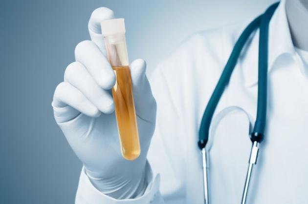 Batteri nelle urine: cause, valori normali e quando preoccuparsi