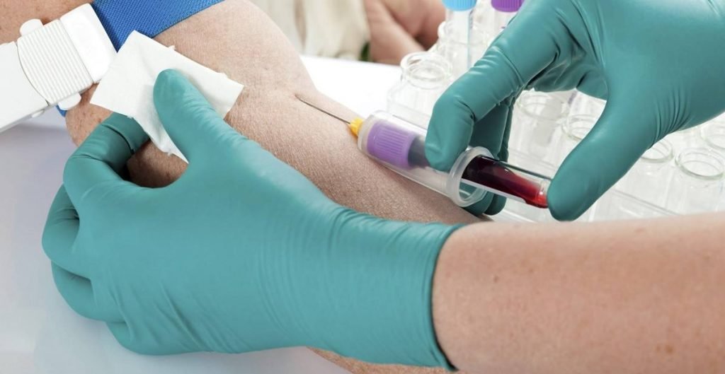 Emazie nelle urine: anche l'esame del sangue è utile per scoprirle