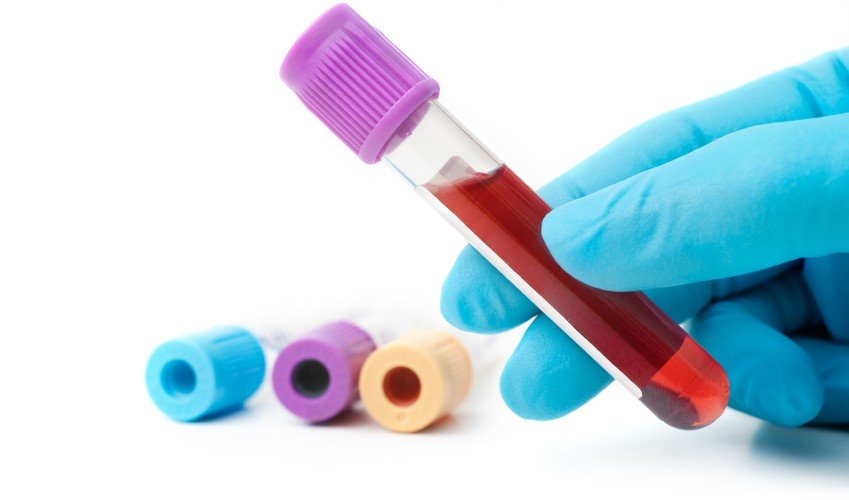 Gli esami del sangue e delle urine sono fondamentali per stabilire lo stato di salute di un paziente.