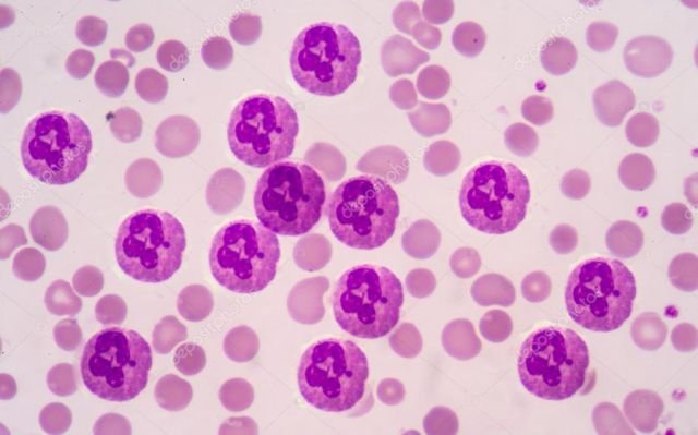 Un'immagine dei neutrofili presa dal microscopio. Si tratta della tipologia di globuli bianchi maggiormente presente nel nostro sangue, con una percentuale che va dal 40 al 75%