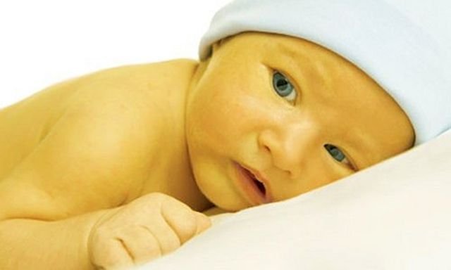 Presente anche nei neonati, la sindrome di Gilbert è un disturbo risolvibile, ma nel frattempo può causare disagi anche di tipo sociale, a causa del colore giallognolo della pelle