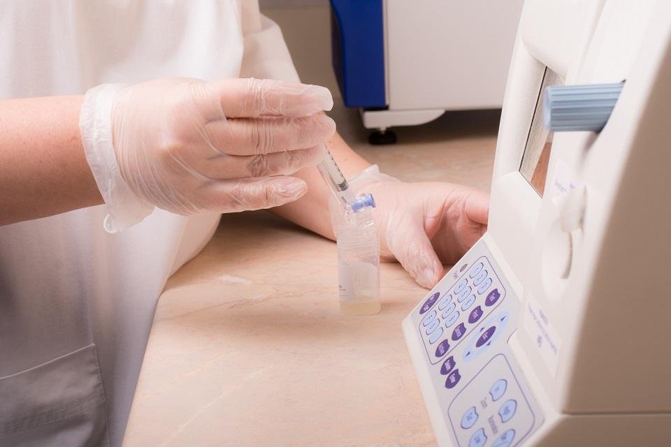 La spermiocoltura viene eseguita in alcuni laboratori specializzati