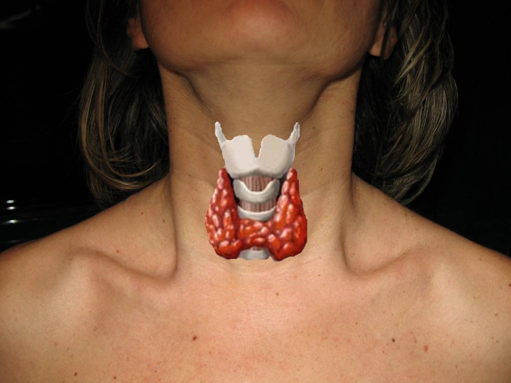 Problemi alla tiroide. Quali sono i sintomi più comuni