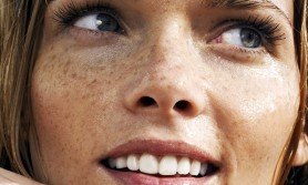 rimedi naturali per pori dilatati del viso