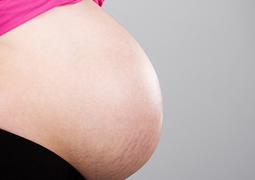In gravidanza la pelle è soggetta ad un forte stress e le smagliature sono una possibile conseguenza
